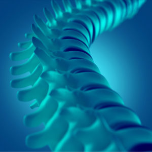 spinal stenosis