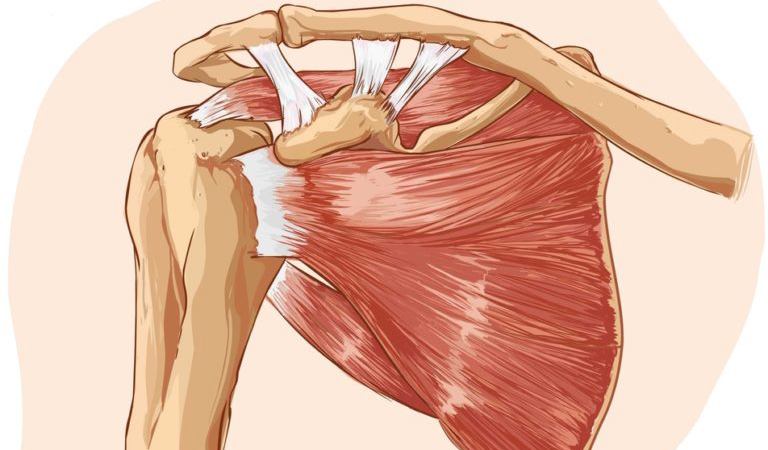 What are Common Signs of Rotator Cuff Injuries Post