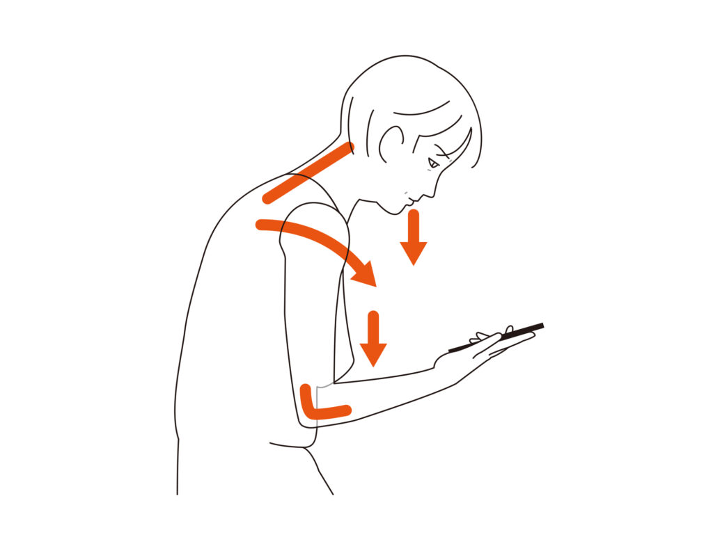 Rounded shoulder posture from looking at a screen