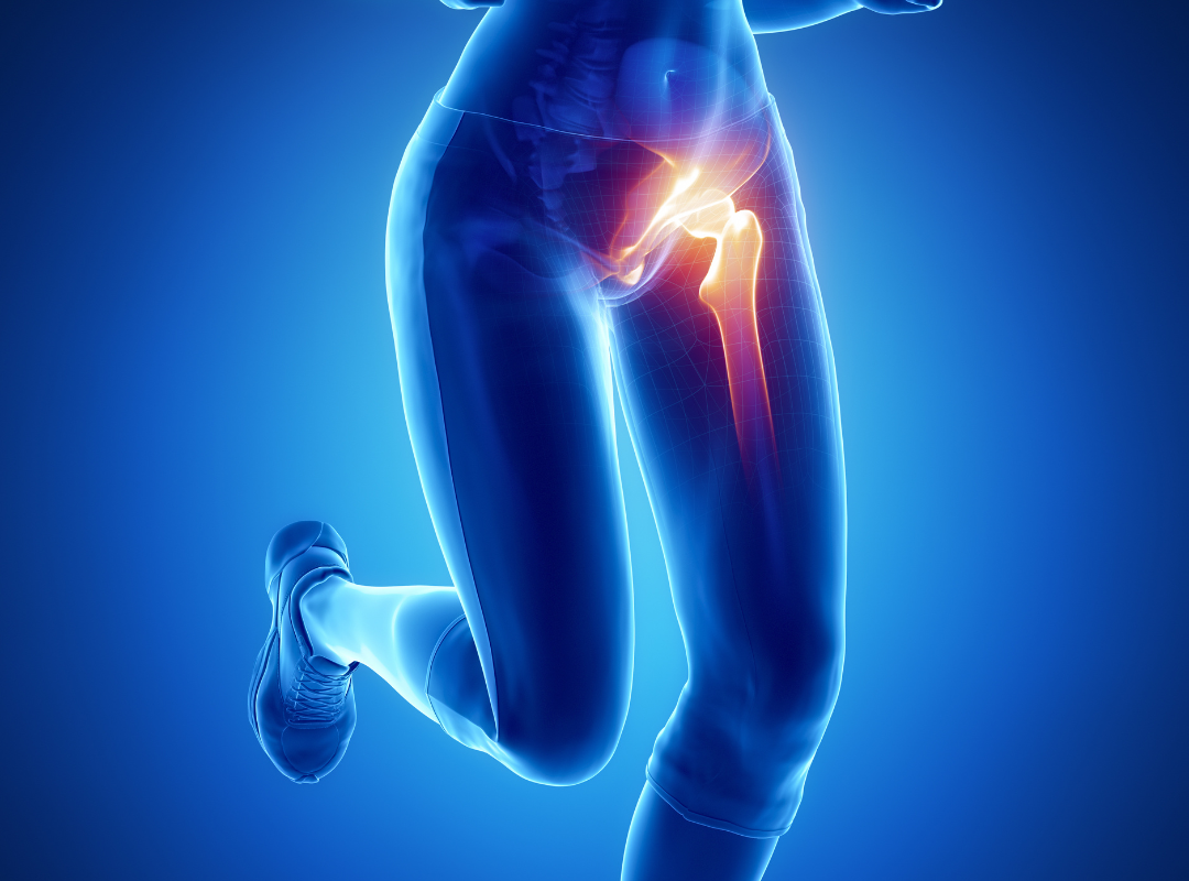 hip pain while running