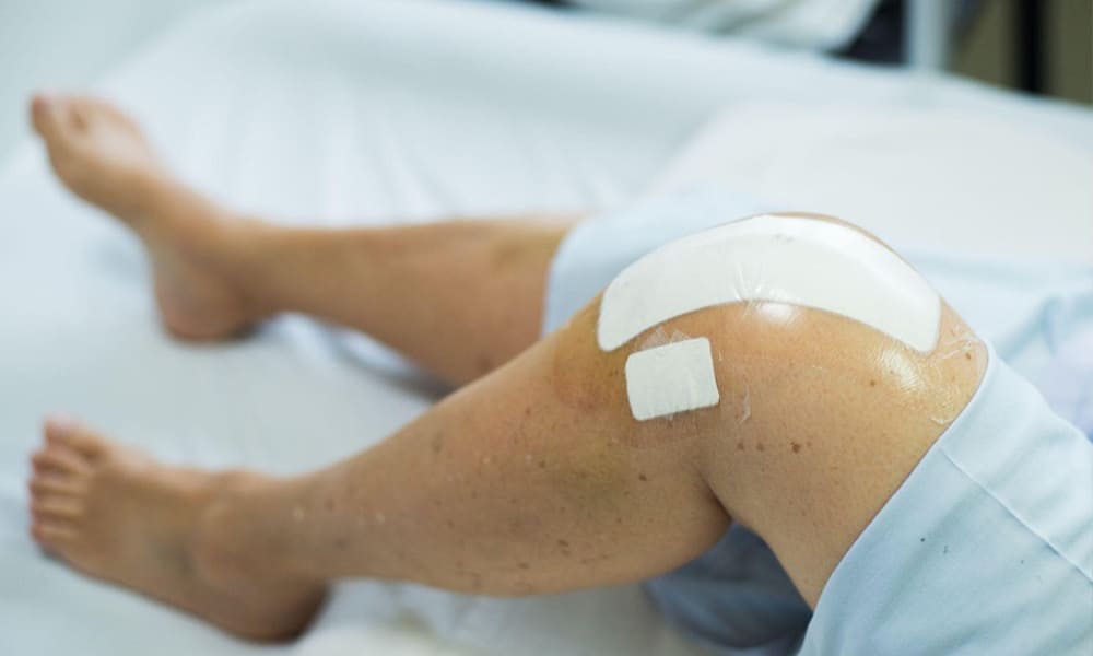 Partial vs. Total Knee Replacements: Treatment, Recovery & What To Expect post