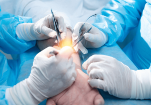 Why Delaying Surgery Could Make Your Pain—and Recovery—Worse post