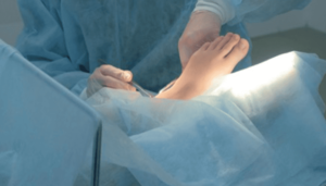Is Ankle Fusion Surgery The Best Option For Chronic Pain In Fishhawk? post