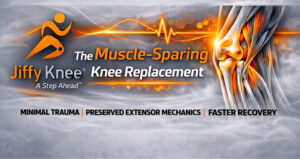 Jiffy Knee Header Section v2