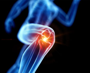 Your Certified Jiffy Knee Surgeons In Tampa Bay Section