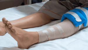 Maintaining Your New Knee: Our Surgeons' Lifestyle Tips After Surgery post