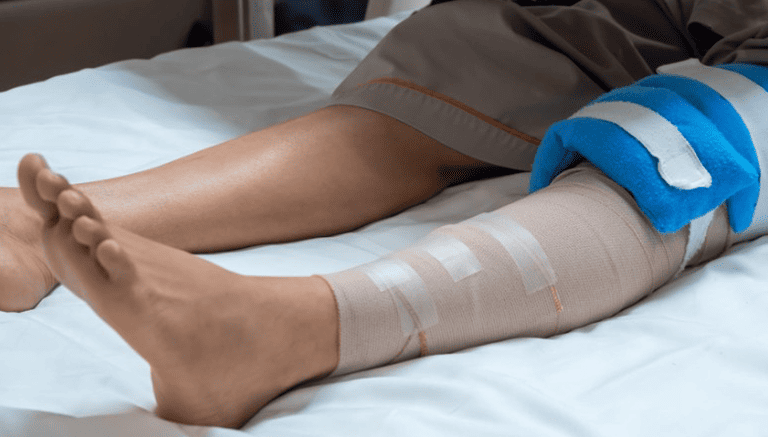 Maintaining Your New Knee: Our Surgeons' Lifestyle Tips After Surgery post