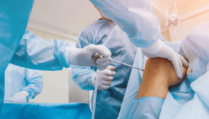 Jiffy Knee vs Non-Surgical Treatments: When Is Surgery the Better Option? post