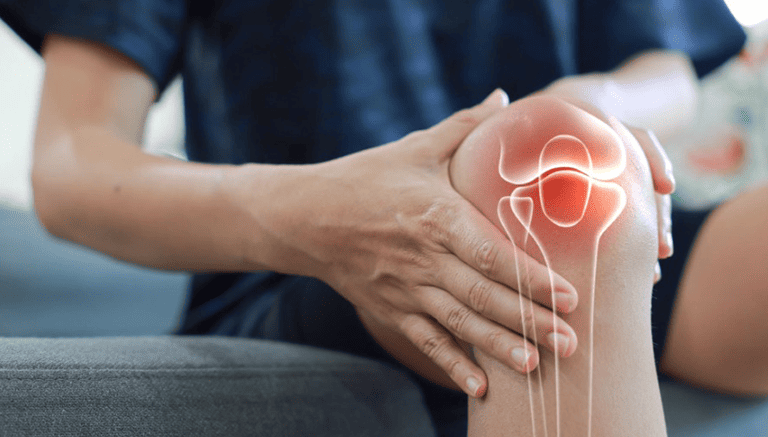 Is Bone-on-Bone Arthritis Always a Reason for Surgery? post